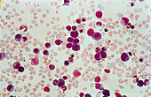 LM of bone marrow cells