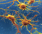 SEM of Alzheimer's disease culture cells