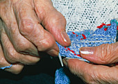 Hands knitting affected by osteoarthritis