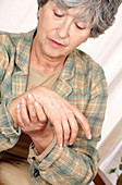 Woman with osteoarthritis