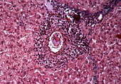 Schistosome parasite egg