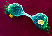 Coloured SEM of breast cancer cells dividing