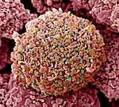 Breast cancer cell,SEM