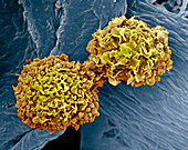 Breast cancer cells,SEM