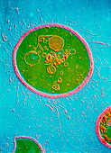 TEM of Cryptococcus neoformans