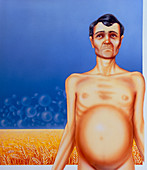 Artist's depiction of coeliac disease