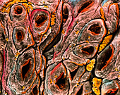 SEM of intestine showing coeliac disease