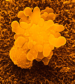 False-colour SEM of T-lymphocyte killer cell
