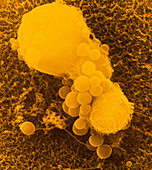 SEM of 2 T-lymphocite cells attacking cancer cell