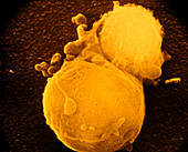 False-col SEM of T-lymphocyte killer cell