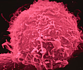 False-col SEM of lymphoblastoid cell