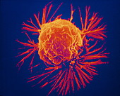 False-col SEM of single cancer cell