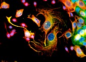 Immunofluorescent LM of mixed human-cancer cells