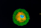 Immunofluorescent LM of a melanoma cancer cell