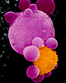 Coloured SEM of lymphocyte attacking cancer cell