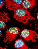 Immunofluores. LM of drug-resistant cancer cells