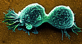 Coloured SEM of cancer cells dividing