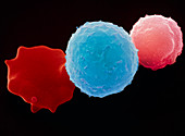 Leukaemia blood cells,SEM