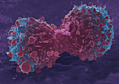 Lung cancer cell division,SEM