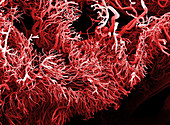 Tumour blood vessels,SEM