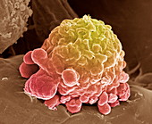 Leukaemia cell,SEM
