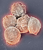 Blood cancer cells,SEM