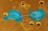 Skin cancer cell dividing,SEM