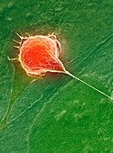 Bladder cancer cell,SEM