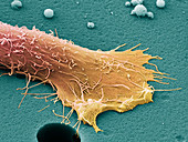 Prostate cancer cell,SEM