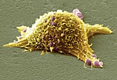 Skin cancer cell,SEM