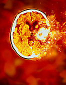 Computer art of an exploding brain in a human head