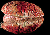 Bloody brain membranes