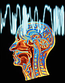 Epilepsy: MRI brain scan and EEG trace