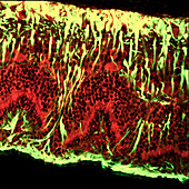 Detached retina,light micrograph