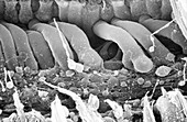 Damaged inner ear hair cells,SEM