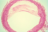 Lm of a section through human coronary heart