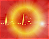 Cardiac arrest: artwork of a dying ECG heart trace