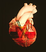 Heart disease research