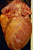 Enlarged heart
