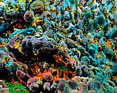 Coloured SEM of E. coli infection of the bladder
