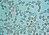 LM of malaria parasite Plasmodium sp. in the blood