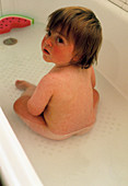 Young child in bath with german measles rash