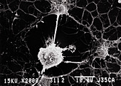 SEM of microglial cell attacking oligodendrocytes