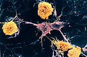 SEM of oligodendrocyte cell eaten in MS