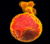 Coloured SEM of a blood cell with erupting malaria