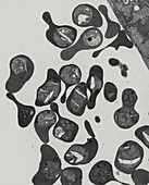 TEM of malaria-infected erythrocytes at ring stage