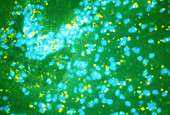 Fluorescence LM of Multiple sclerosis brain tissue