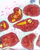 Malaria parasites,TEM