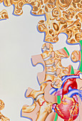 Artwork of menopause: osteoporosis,heart disease