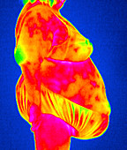 Obese woman,thermogram